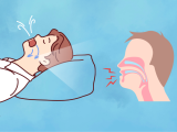 Atacando la apnea del sueño desde su raíz