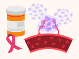 inmunidad antimetastásica, AAS, metástasis