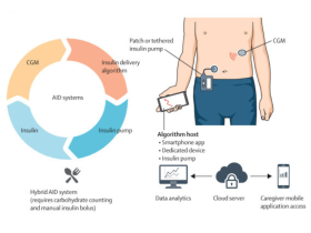 diabetes tipo 1, insulina, teplizumab, insulinas de nueva generación, insulinas sensibles a la glucosa