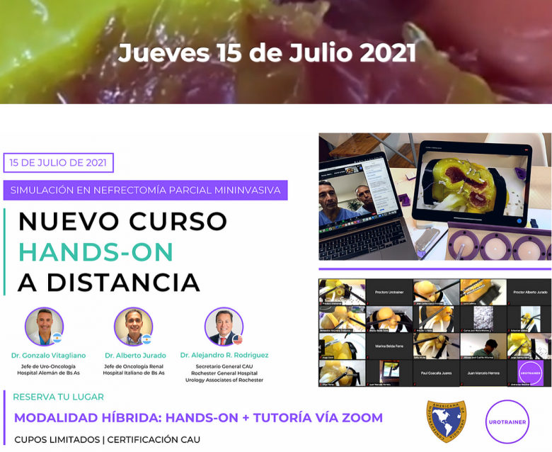 Curso HANDS-ON a distancia de simulación en nefrectomía parcial mininvasiva
