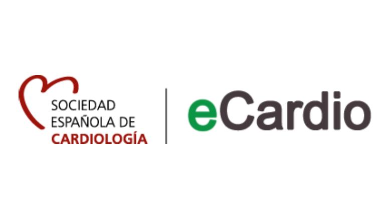 eCardio