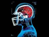 Daño cerebral y deporte de alto impacto