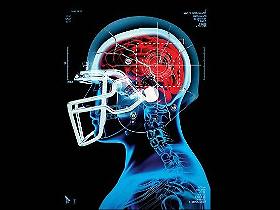 Daño cerebral y deporte de alto impacto