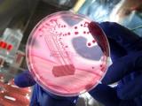 Petri y el avance extraordinario de la microbiología