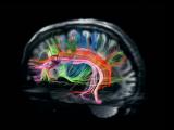 Conexiones neuronales en constante desarrollo