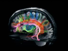Conexiones neuronales en constante desarrollo