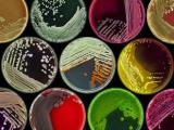 Sífilis y su ruta bacteriológica