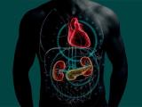 síndrome ckm, síndrome cardiovascular renal metabólico 